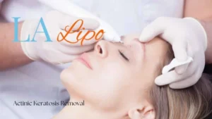 Woman receiving Actinic Keratosis Removal Treatment Clifton