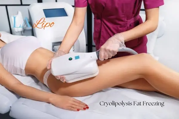 Woman receiving coolsculpting Clifton treatment on her thighs