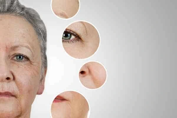HIFU Facelift Clifton from LA LIPO